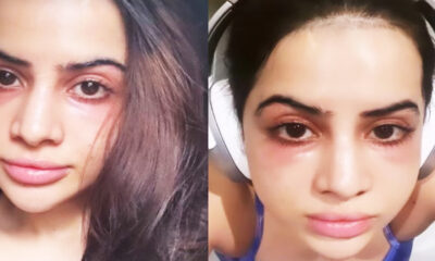 Urfi Javed Got Under Eye-Fillers After Facing Severe Trolling For Dark Circles: ‘Why Did I Do This’