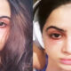 Urfi Javed Got Under Eye-Fillers After Facing Severe Trolling For Dark Circles: ‘Why Did I Do This’